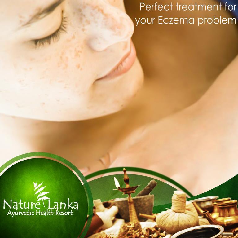 Nature Lanka Ayurveda Resort - All Meals And Ayurveda Treatments With Yoga Tangalle Exterior photo